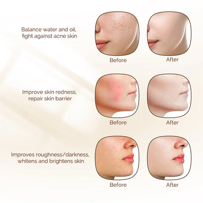 Wireless 7-Color LED Facial Mask – Skin Rejuvenation